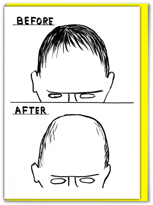 David Shrigley Card - Before After
